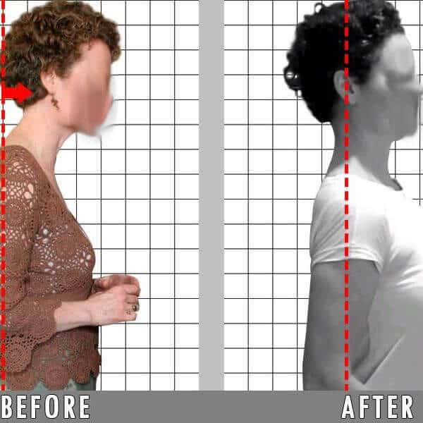 improve your posture | st ives chiropractor | epstein chiropractors