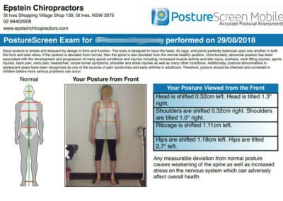 Posture Screening