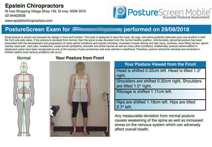 st ives chiropractor | posture screening | epstein chiropractors